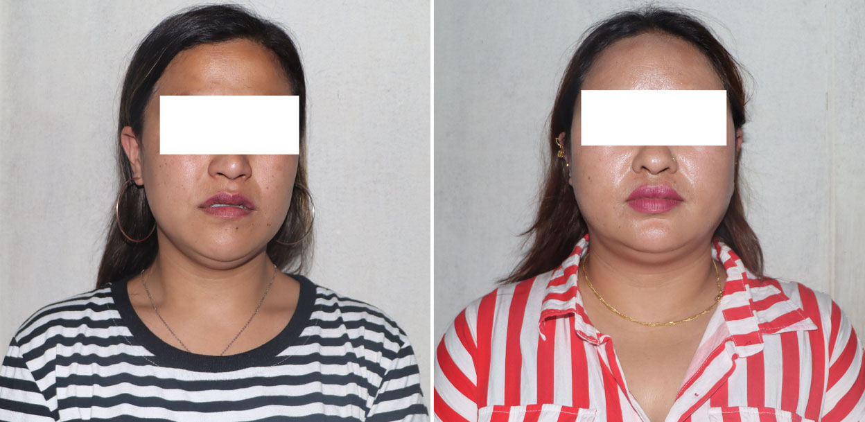 हनी ट्रयापमा पारेर काठमाडौंमा घर र ४ आना जग्गा माग्ने २ महिला पक्राउ